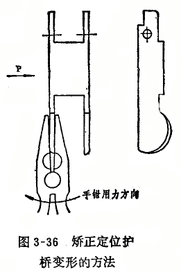 內徑百分表定位護橋偏位的修理方法